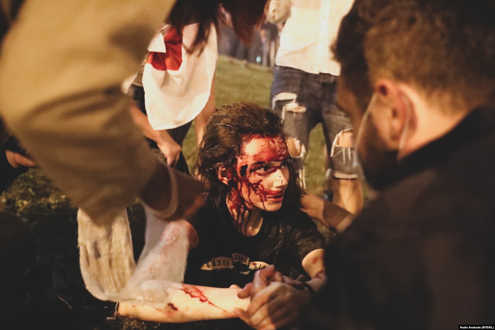 Maryja Saizawa, nachdem sie durch eine Blendgranate am 9. August 2020 in Minsk verwundet wurde. / Foto © Radio Svaboda (RFE/RL) 